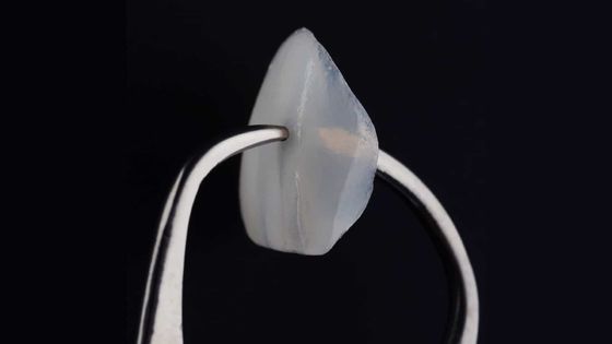 Ästhetisches Porzellan Emax Laminat Veneers professionelle dünne Schale