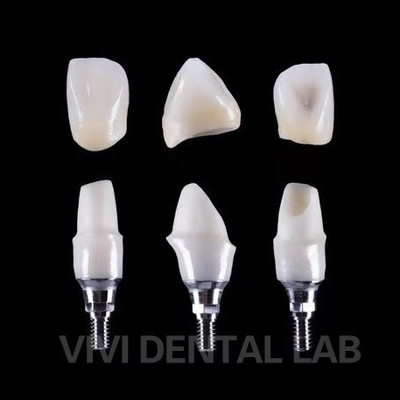 Zahnimplantat Tibase Zirkonia Abutment Titan Genauigkeit angepasst