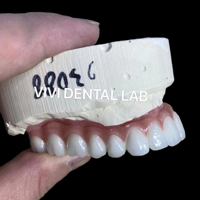 Natürlich aussehende ästhetische Schraube mit Zirkonienimplantat Krone Langlebig