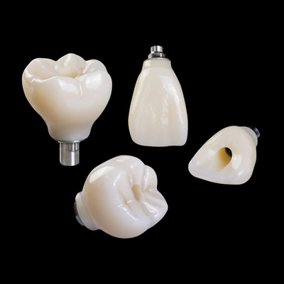Professionelle Zirkonia Zahnimplantate Krone Titan CAD CAM
