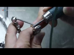 PFM Kronen und Brücken