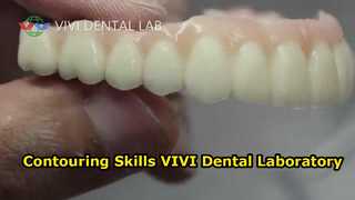 Formkonturierungsfähigkeiten VIVI Dental Laboratory China
