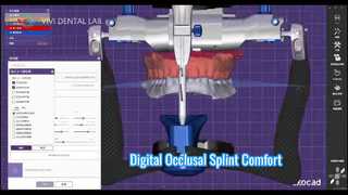Digitale Aufbissschiene Accurate Comfort