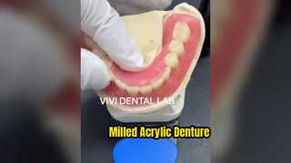 Gefräste Acrylprothese von hoher Qualität